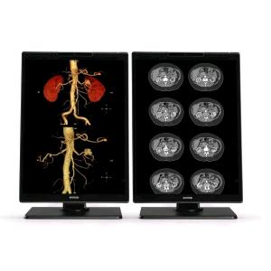 MONITOR MEDICALE 21" 3MP NIO COLOR SNES 1H1F NC EXCL